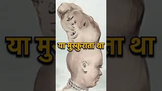 The Amazing TwoHeaded Boy of India [upl. by Iak]