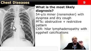 Chest case Diagnose it internalmedicine cme usmle محاضراتباطنة ecg clinical [upl. by Amikehs886]