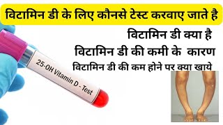 Vitamin D की कमी के कारण  Vitamin D के लिए test  Vitamin D test normal range vitamind vitamin [upl. by Younglove]