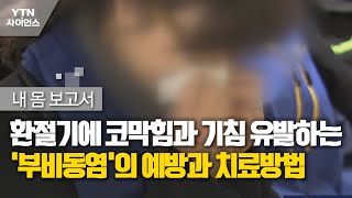 내 몸 보고서 환절기에 코막힘과 기침 유발하는 부비동염의 예방과 치료방법  YTN 사이언스 [upl. by Zenger462]