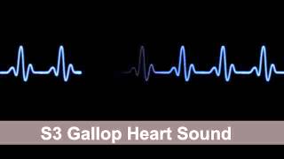 S3 Gallop Heart Sound Collection For Auscultation Skills [upl. by Sura]