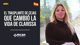 Clarissa de México habla sobre su experiencia del trasplante de cejas en MCAN Health [upl. by Namor518]