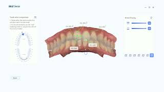 Intraoral Scanner Shades Measurement Using Guides [upl. by Mandych]