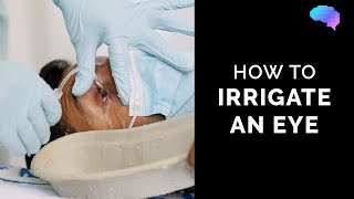 How to Irrigate an Eye  How to Wash an Eye  Eye First Aid  OSCE Guide  UKMLA  CPSA [upl. by Kus]