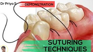 SUTURING TECHNIQUESDEMONSTRATION [upl. by Levan]