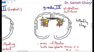 Systemic pathology 15  CNS 1 tumors of CNS  DRSAMEH GHAZY [upl. by Nabal862]