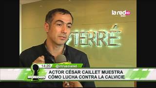 César Caillet se sometió a un implante de cabello [upl. by Lucic514]