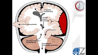 Intracranial Pressure 5 Herniation Syndromes 2 ضغط المخ [upl. by Hsatan175]