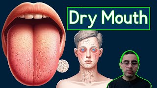 Top 7 Causes of Dry Mouth Xerostomia and Treatment [upl. by Yllib]