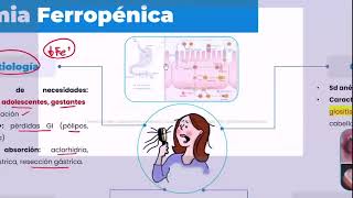 RM 2024 Hematología 7 Anemia Enf Von Willebrand Hemofilia Linfomas Leucemias agudas y crónicas [upl. by Eema]