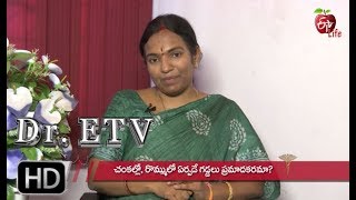 Swollen Lymph Nodes  Dr ETV  30th May 2019  ETV Life [upl. by Nirihs]