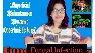 Fungal Infection Classification Part 3Mycology [upl. by Schinica365]