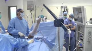 Shoulder Arthroscopy Surgery [upl. by Sivra788]