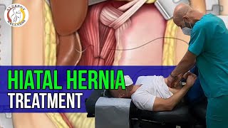 Hiatal Hernia Treatment  Synergy Wellness Chiropractic amp Physical Therapy PLLC [upl. by Lenoyl492]