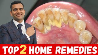 Top 2 Remedies To Remove Dental Plaque  Remove Dental Plaque and keep Oral Hygiene Healthy At Home [upl. by Ecyla645]