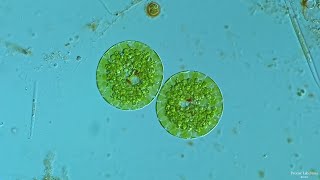 Euglena Encystment  A Rarely Seen Event [upl. by Mochun]