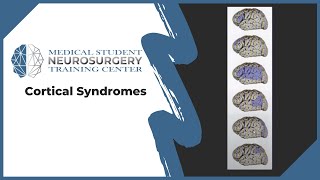 Cortical Syndromes [upl. by Rowe]