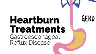 Treatments for Heartburn  Gastroesophageal Reflux Disease GERD  Gastrointestinal Society [upl. by Eenitsed]