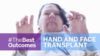 Face and Double Hand Transplant Journey Joe Dimeos Story [upl. by Garrard542]