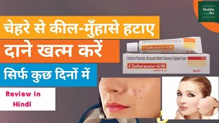 Neoclobenate Gm Cream Review in Hindi । HealthyBro। [upl. by Adieno]