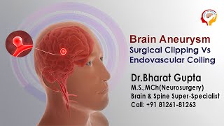 Brain Aneurysm Surgical Clipping Vs Endovascular Coiling I Dr Bharat Gupta [upl. by Lener]