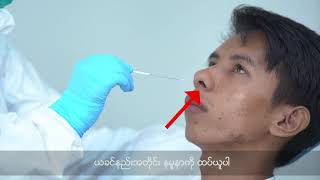 Sample Collection Oropharyngeal Swab amp Nasopharyngeal Swab [upl. by Nihi]