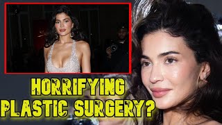 What did fans notice about Kylie Jenners face Is she really ruined her face by using surgeries [upl. by Laney]