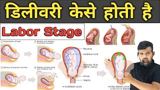 डिलीवरी केसे होती है  Labor Stage  Pregnancy  Medicine  Treatment  Hospital Knowledge  Doctor [upl. by Lseil]