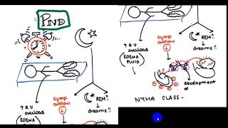 ORTHOPNEA AND PND AND PLATYPNEA AND TREPOPNEA 4TH YR [upl. by Conrado]