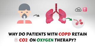 Oxygen Induced CO2 Narcosis in COPD Patients [upl. by Niamor975]