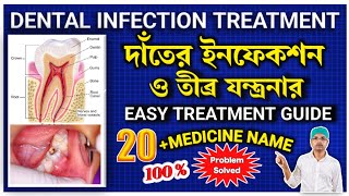 Dental infection treatment in banglaTooth infection treatmentTooth infection medicinedental [upl. by Kinsman]