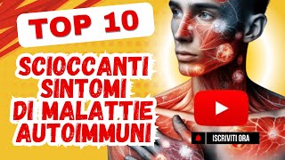 Problemi alla pelle  Sintomi di una malattia autoimmune [upl. by Olyhs]