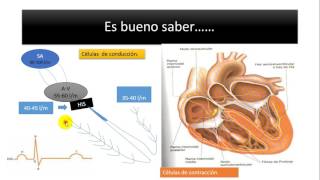 ANTIARRÍTMICOS  INTRODUCCIÓN  CLASIFICACIÓN Y MECANISMO DE ACCIÓN GENERAL  13 [upl. by Atinid]