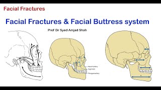 Facial Fractures amp Facial Buttress system  Oral amp Maxillofacial Surgery  Syed Amjad Shah [upl. by Suciram]