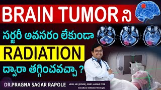 Radiosurgery for brain tumor  Cancer  DrPragna Sagar Rapole  Kaizen Hematology Oncology Network [upl. by Adiel]