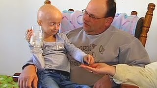 Progeria clinical trial at Boston Childrens Hospital [upl. by Amaso]