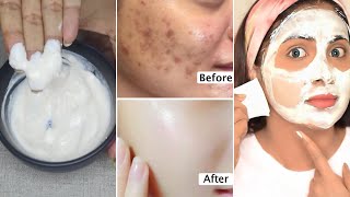 3 Days Skin TransformationGet rid of skin blemishes spots large poresget bright tight glass skin [upl. by Celestyn]