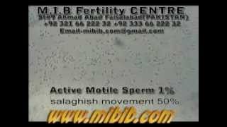 active motile sperm 1 sluggish motile 50 videolow sperm count video [upl. by Elinet]