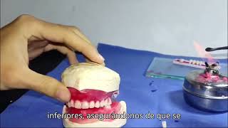 Enfilado dental  Carlos Escorcia  Jennifer Vega [upl. by Gerry]