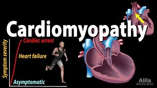 Cardiomyopathy animation [upl. by Morell966]