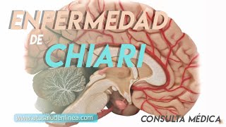 Sistema nervioso Enfermedad de Arnold Chiari [upl. by Ailene]