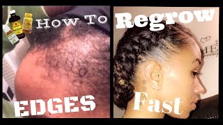 How To Regrow Edges On Natural Hair Fast [upl. by Olathe570]