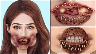 ASMR Animation Remove Maggot From Face  Deep Cleaning Animation  Universe ASMR [upl. by Elaen]