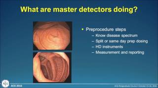 Improving Adenoma Detection Rates [upl. by Yaya]