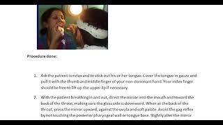 Indirect Laryngoscopy Head mirror IDL mirrow Laryngoscope Vocal cord vibrations amp movements [upl. by Nahtanha]