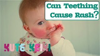 Can Teething Cause Rash in Babies  Natural Teething Rash Remedies [upl. by Ortrude]