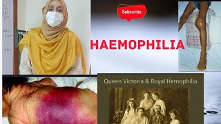 Haemophilia [upl. by Naujid]