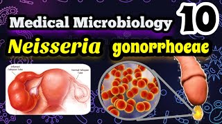 Neisseria gonorrhoeae شرح بالعربي البكتيريا المسببه لمرض السيلان وطرق علاجه [upl. by Atteuqram]