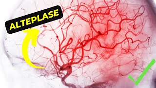 Alteplase Understanding its Mechanism of Action and Potential Side Effects [upl. by Anaerb]