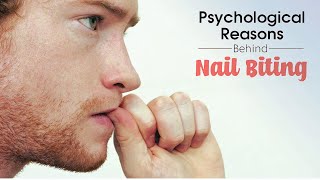 Nail Biting Psychology  Onychophagia [upl. by Foscalina]